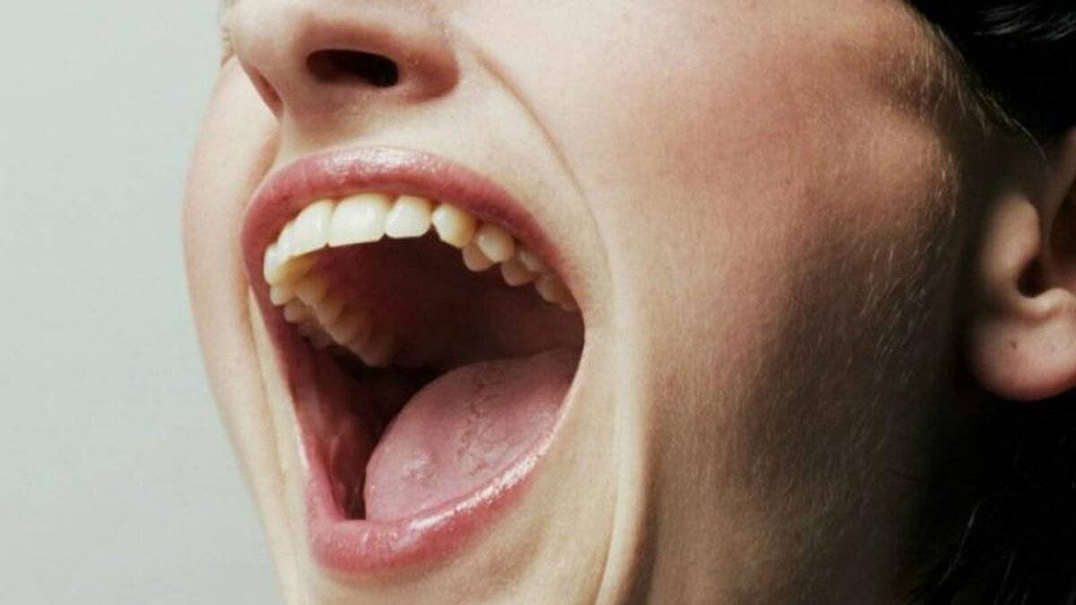 Damak yarası için en tesirli doğal sistemler